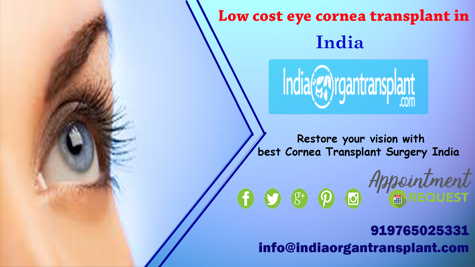 low cost eye transplant surgery in India