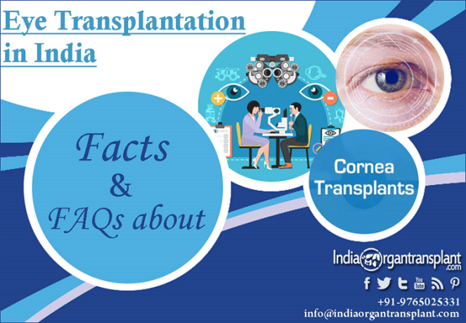 Facts and FAQs about Eye Transplantation